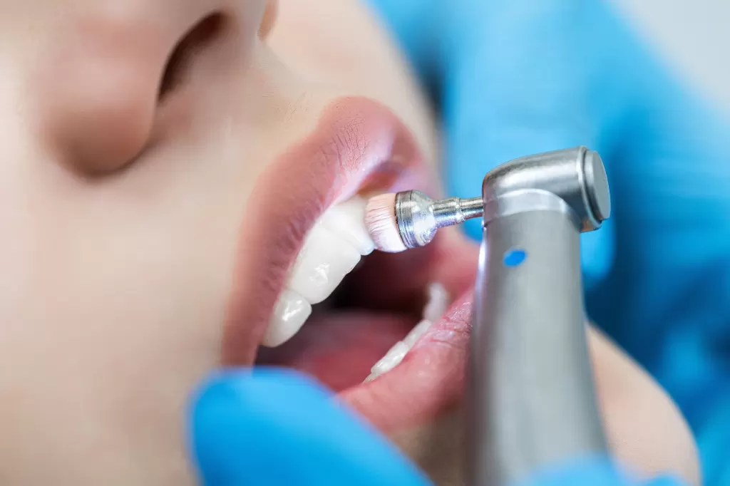 Close-up of a dental handpiece on a patient's teeth during treatment