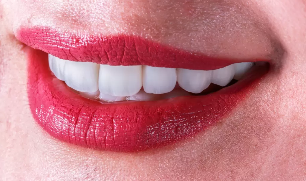 Vorher-Nachher, VDC Dental Clinic