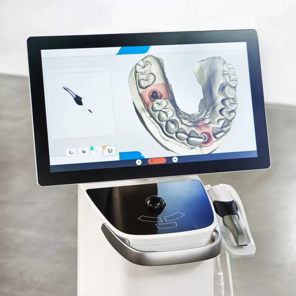 Технології цифрової стоматології в Turkey Dental Clinic, Анталія