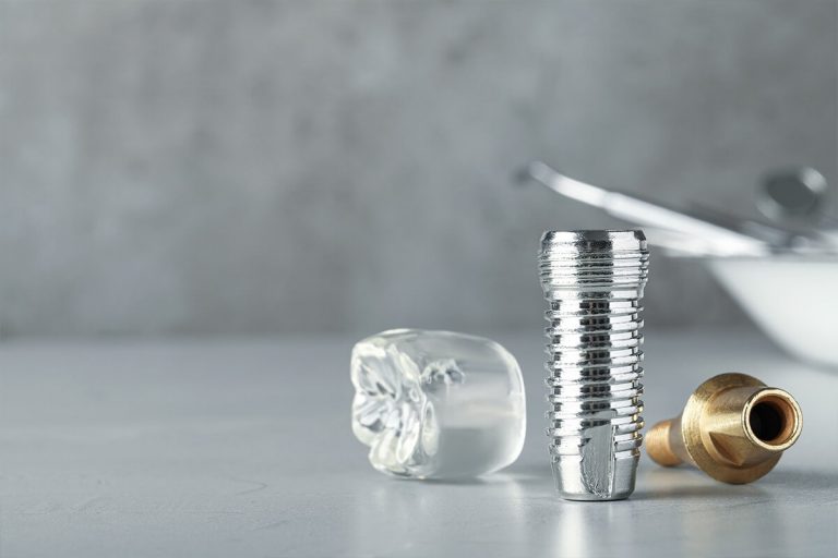 dental implant