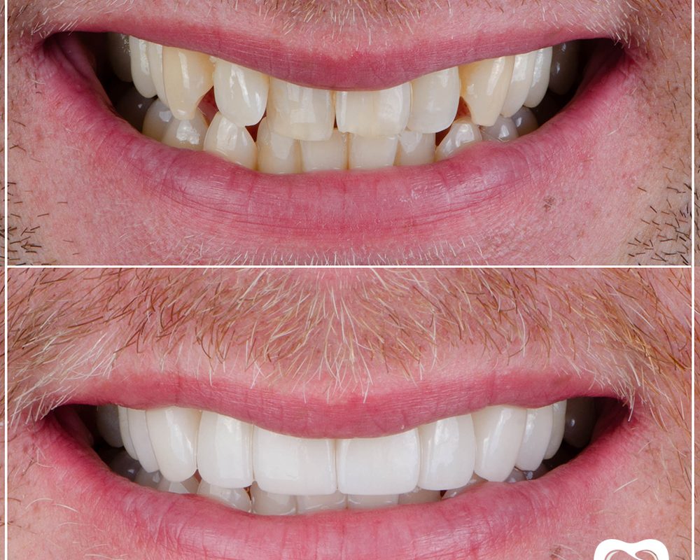 Prosthetic Dentistry