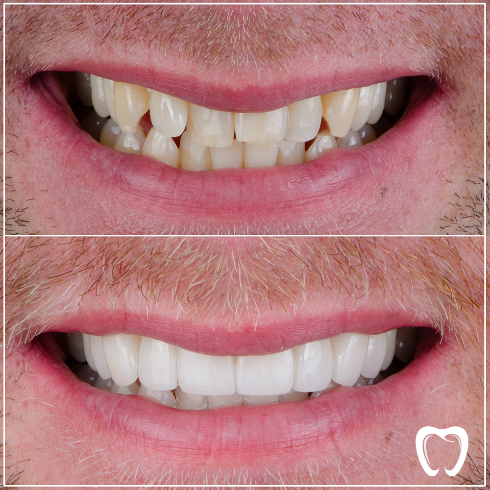 Prosthetic Dentistry