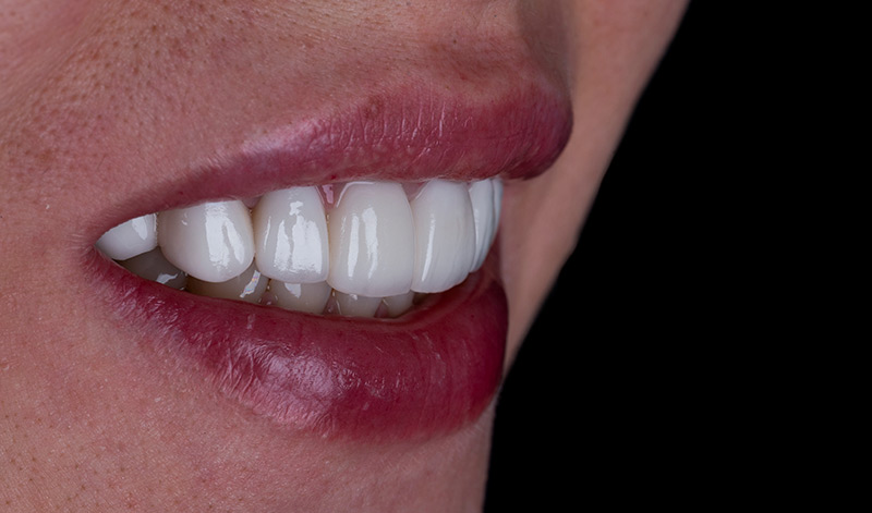 Dental Smile