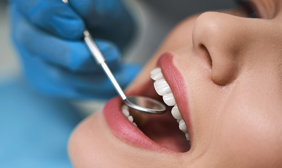 Dental Veneer Packages