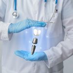 Implant Dentire en Turquie