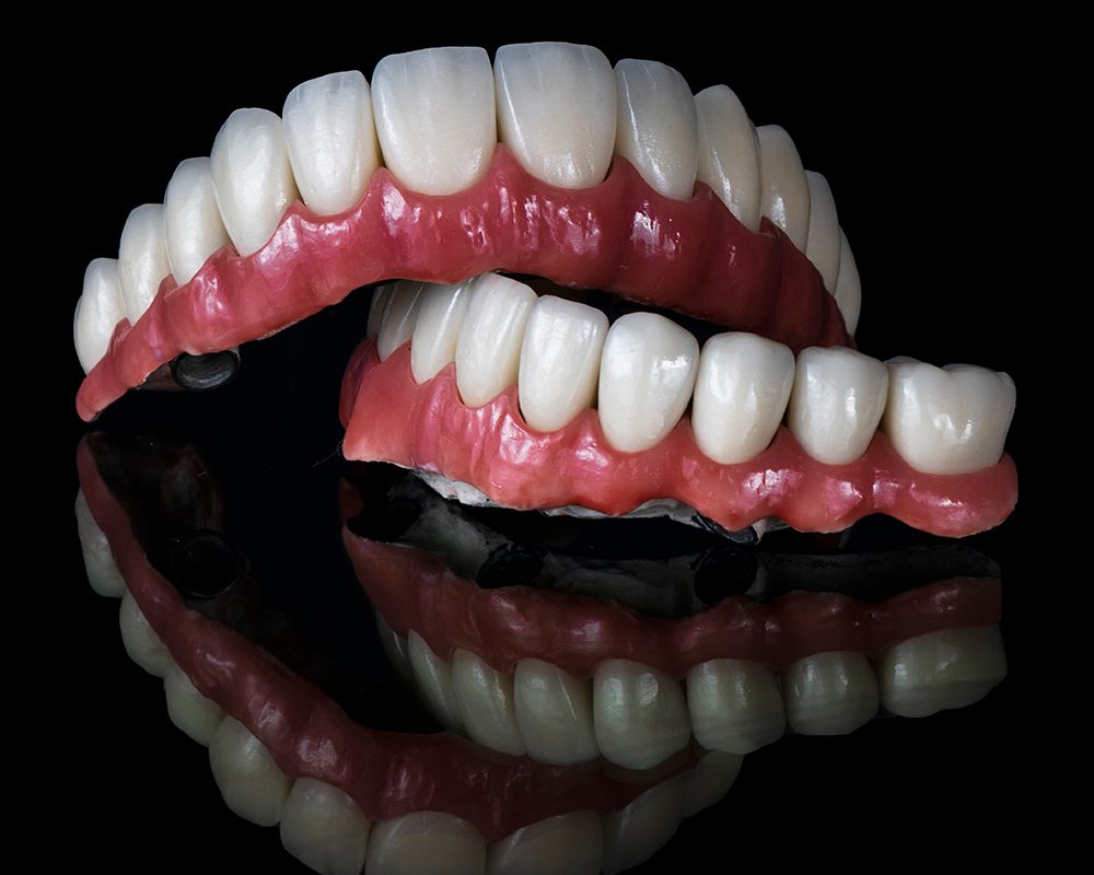 All on Six, All on 6, All on 4