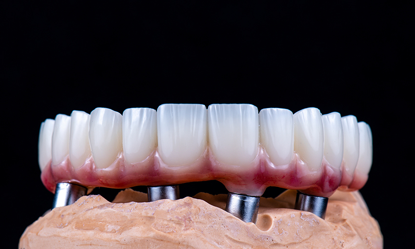 dental clinic in turkey