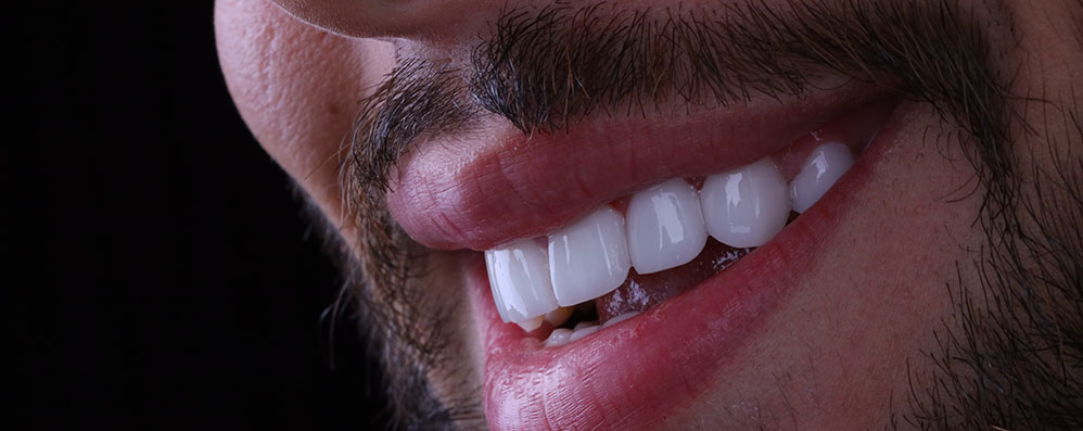 Same Day Dental Implants in Turkey