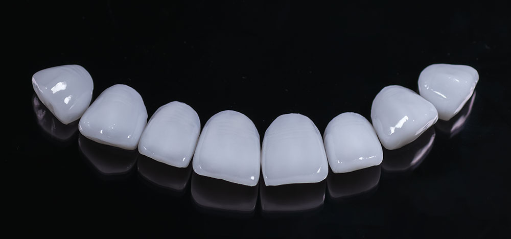 Veneers Turkey