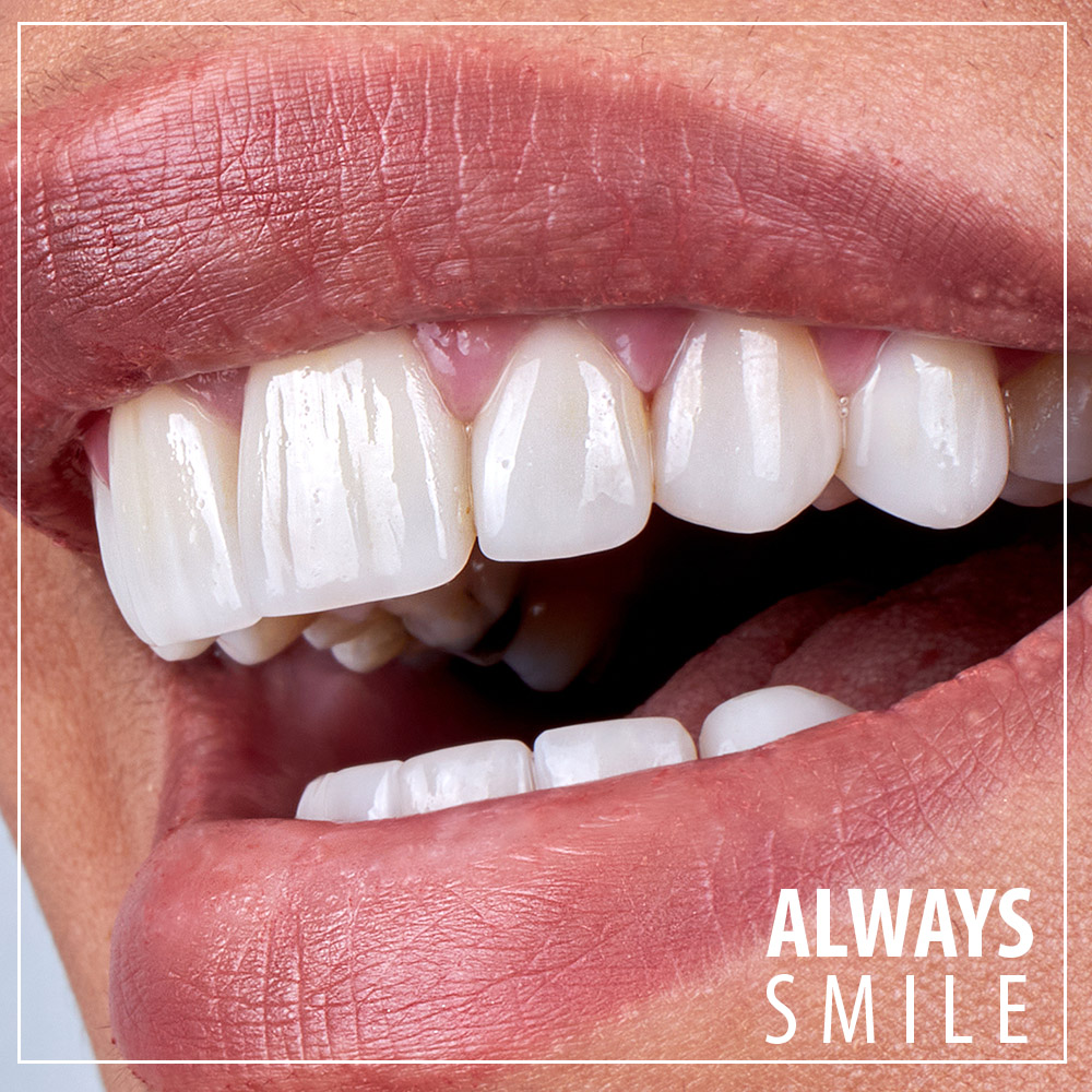 Teeth in Turkey, Cosmetic Dentistry