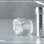 Dental Implant and Remove