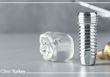 Dental Implant and Remove