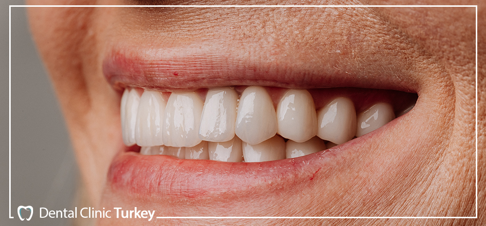 Screwless Dental Implants