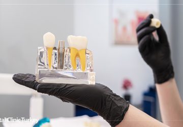 Jawbone Short Implant