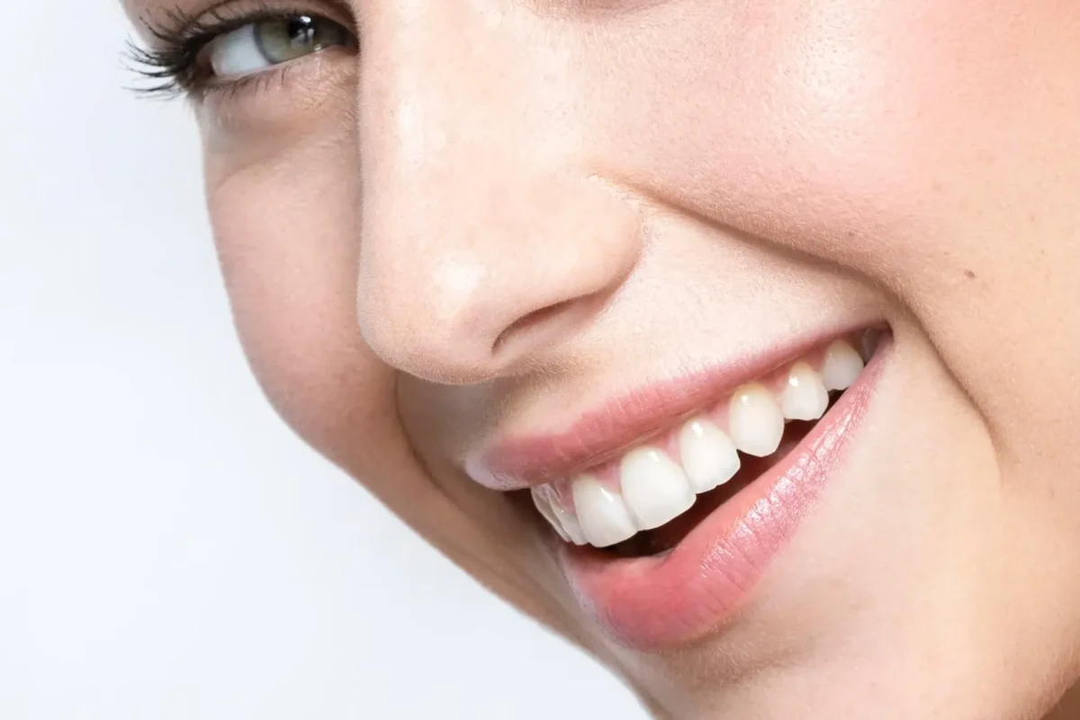 Dental Tourism Turkey Packages 2026: What's Actually Included and What to Watch Out For
