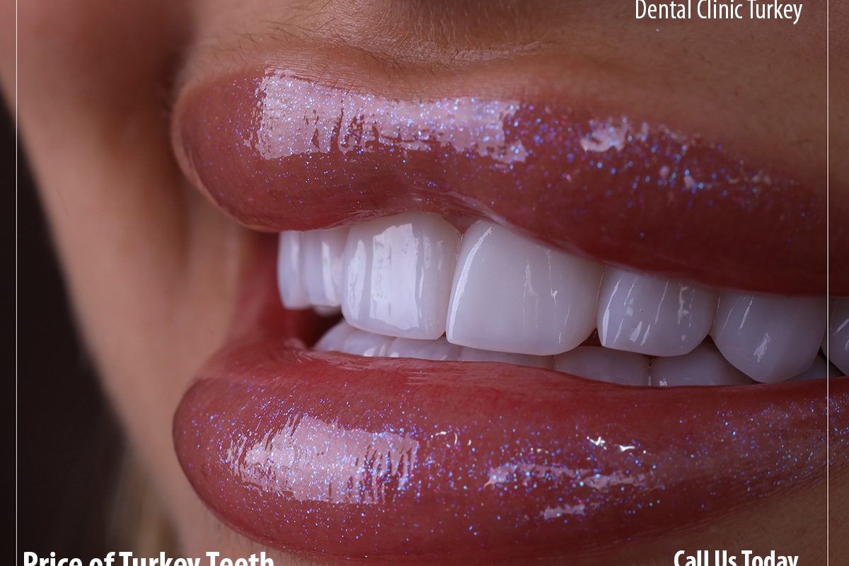 Cost of Turkey Teeth