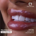 Cost of Turkey Teeth