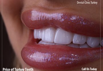 Cost of Turkey Teeth
