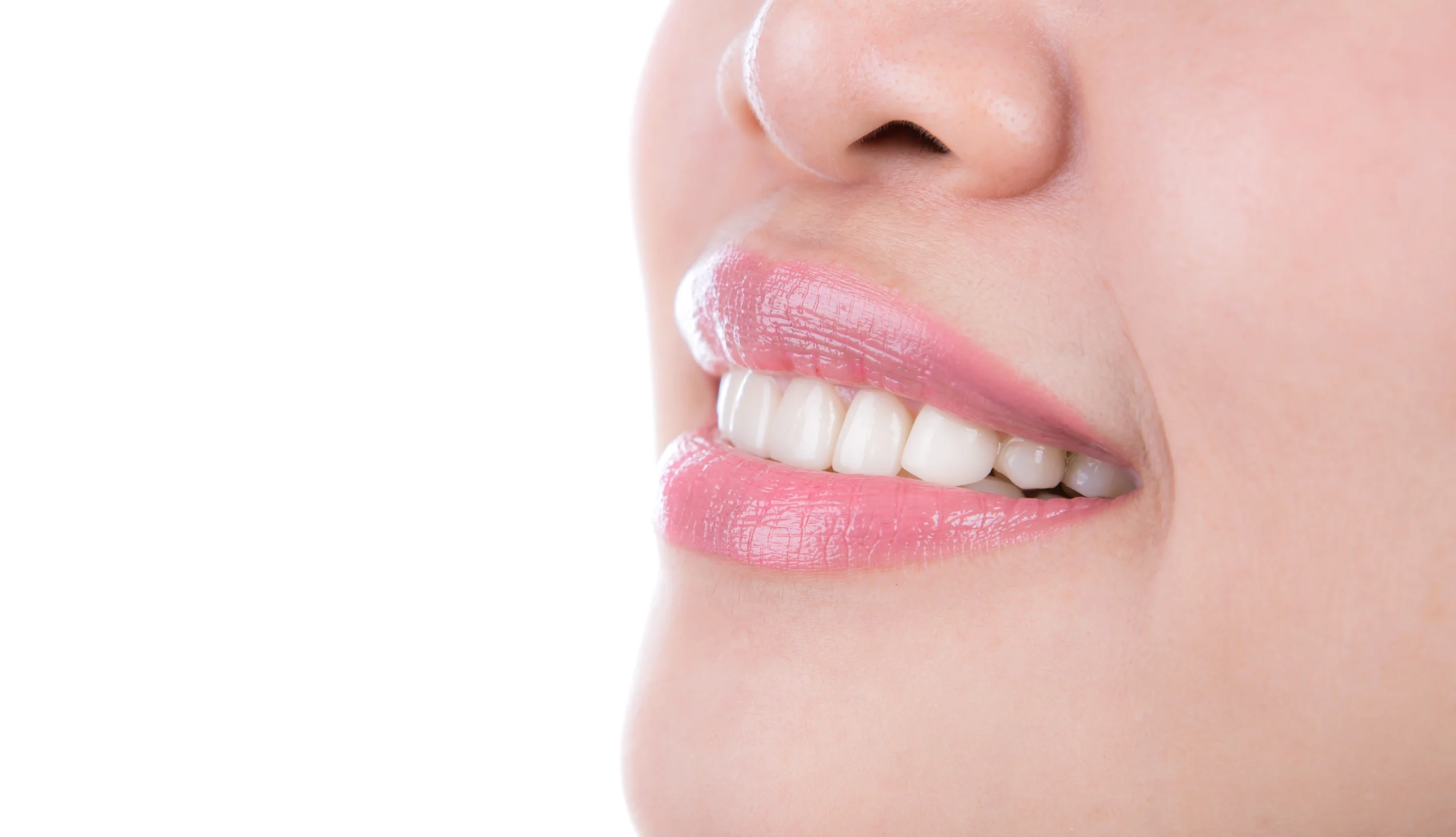 Smile makeover result - healthy white teeth