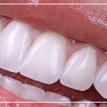 Turkey Teeth Perfect white