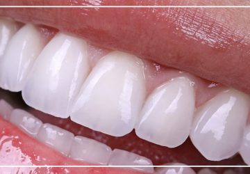 Turkey Teeth Perfect white