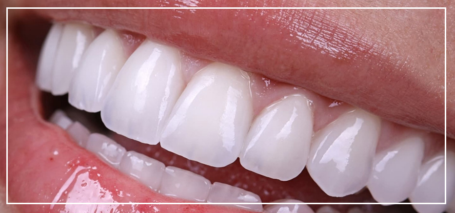 Turkey Teeth Perfect white