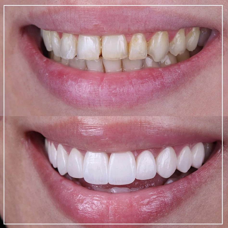 Young Woman's Teeth