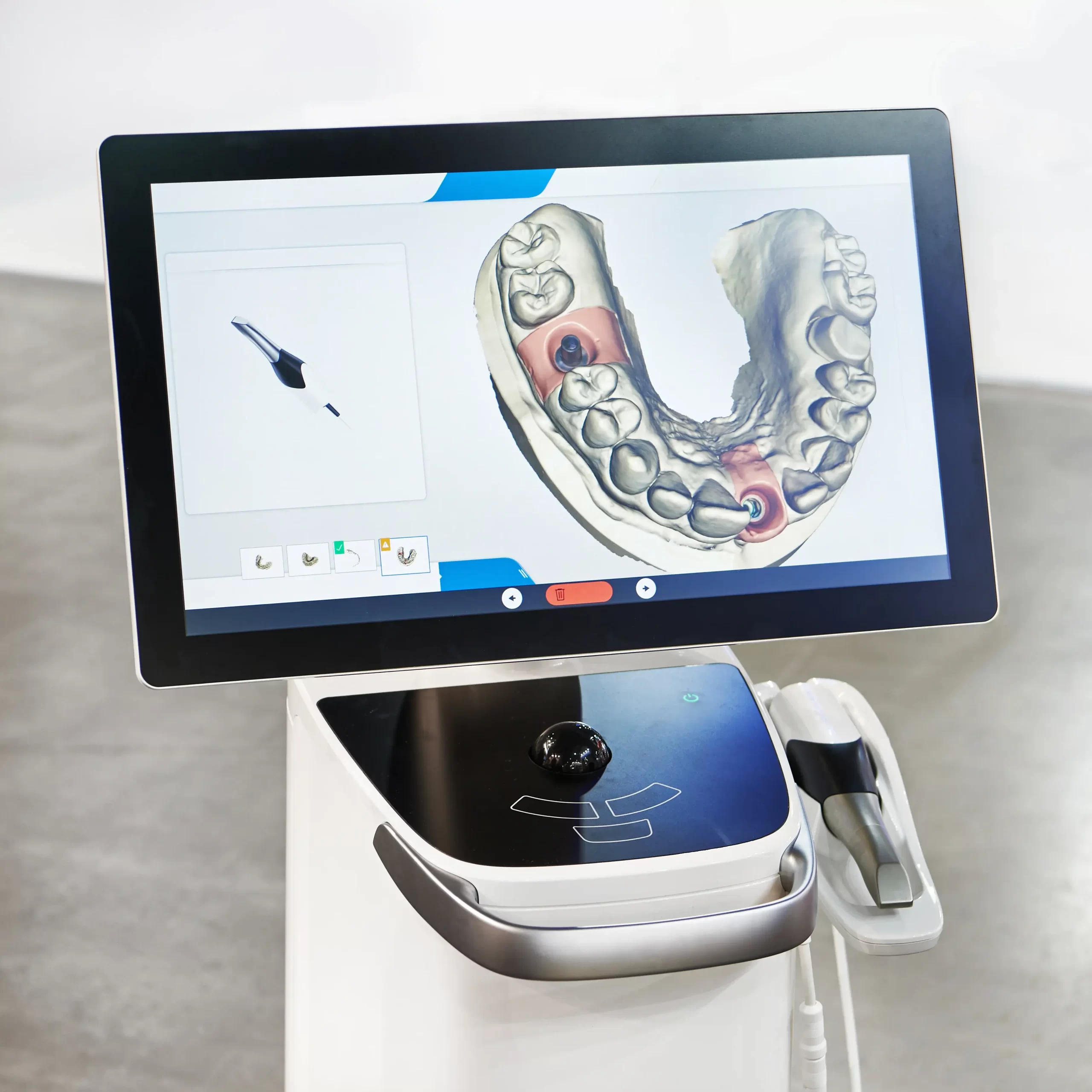 Tecnología de odontología digital en Turkey Dental Clinic Antalya
